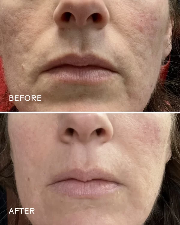 Purify Gel Cleanser - Image 2